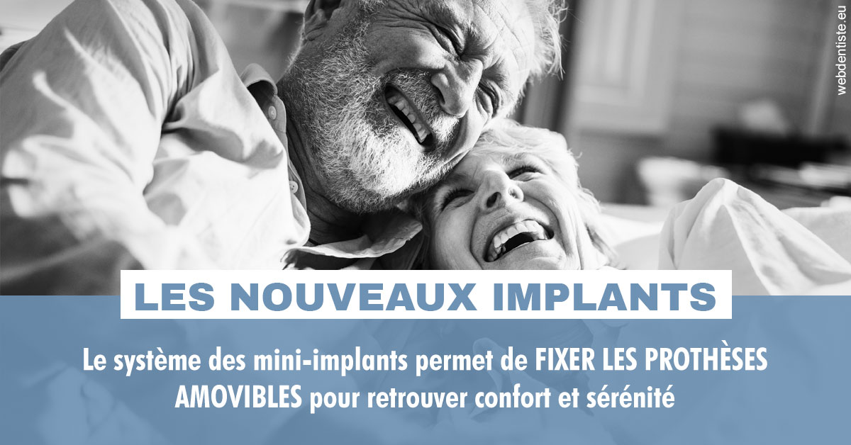 https://selarl-choblet.chirurgiens-dentistes.fr/Les nouveaux implants 2
