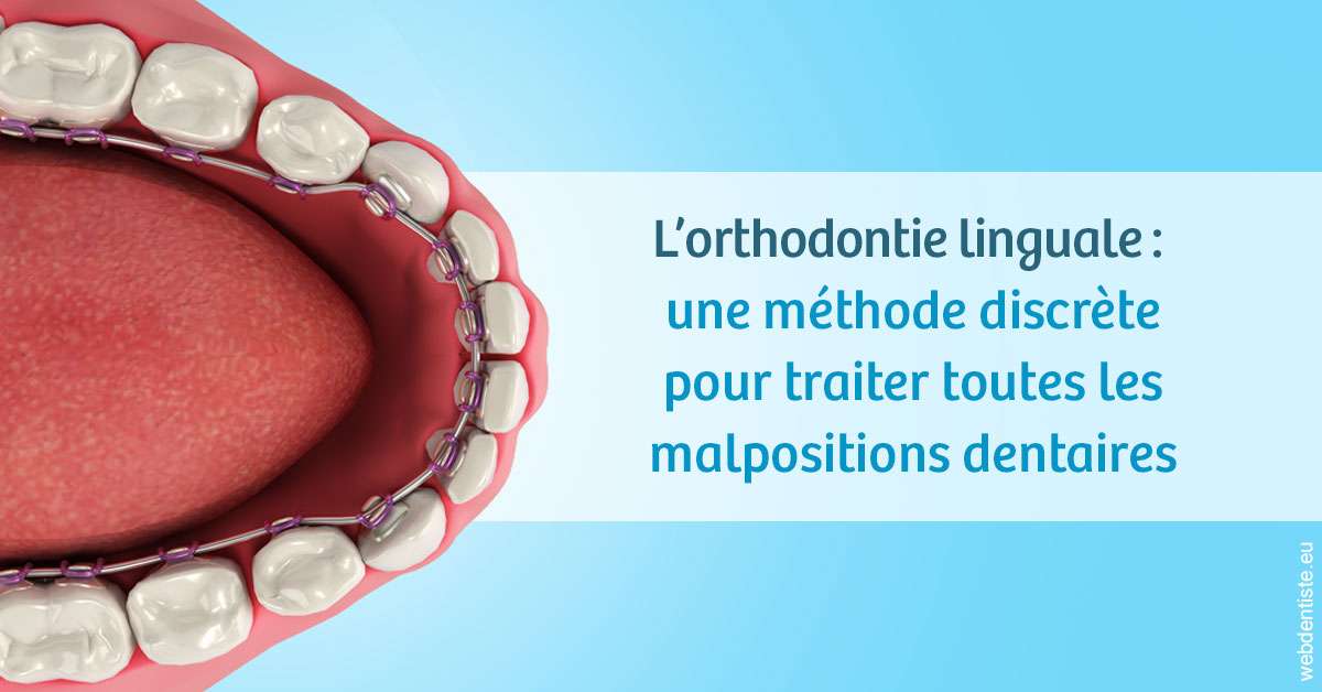 https://selarl-choblet.chirurgiens-dentistes.fr/L'orthodontie linguale 1