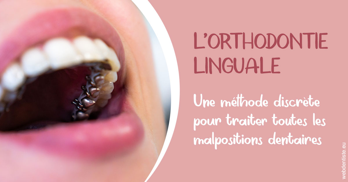 https://selarl-choblet.chirurgiens-dentistes.fr/L'orthodontie linguale 2