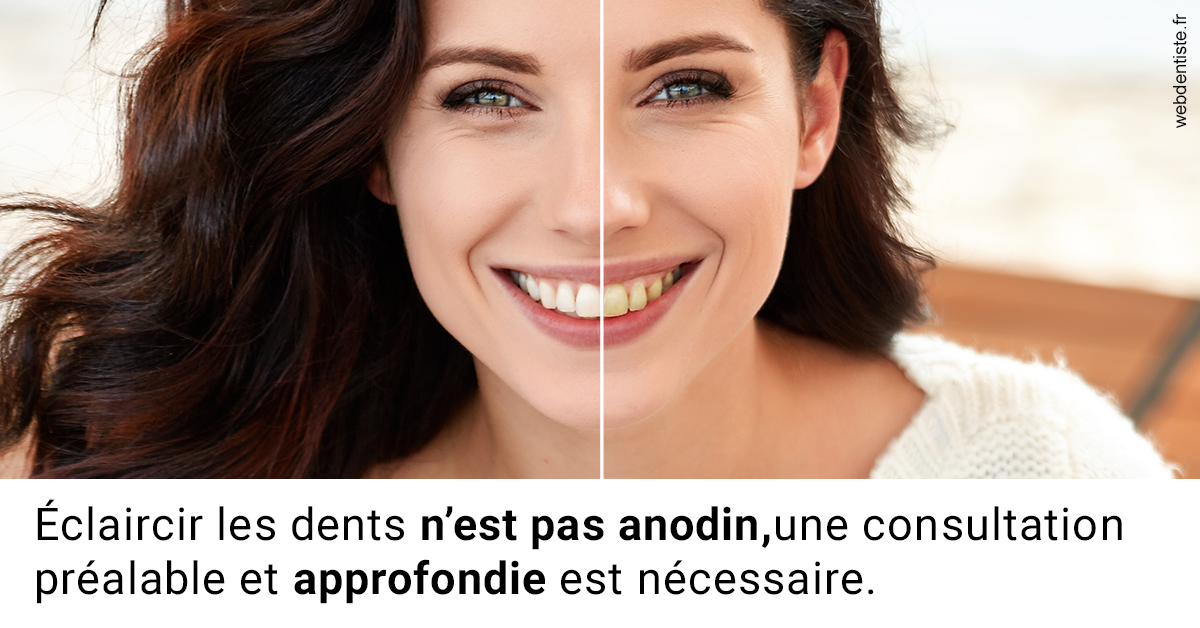 https://selarl-choblet.chirurgiens-dentistes.fr/Le blanchiment 2