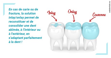 https://selarl-choblet.chirurgiens-dentistes.fr/L'INLAY ou l'ONLAY