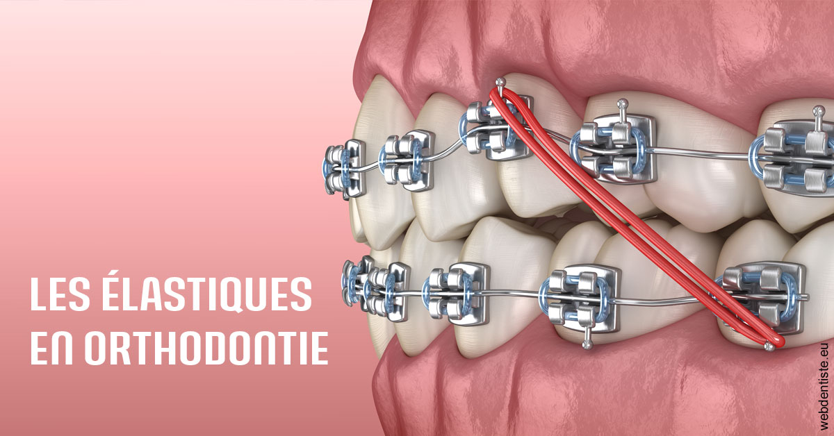 https://selarl-choblet.chirurgiens-dentistes.fr/Elastiques orthodontie 2