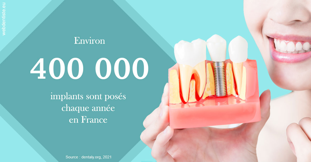 https://selarl-choblet.chirurgiens-dentistes.fr/Pose d'implants en France 2